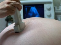 ultrasound-2-1435010.jpg